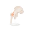 Modelo Anatomico Articulacion de Cadera Tamaño Natural