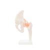 Modelo Anatomico Articulacion de Cadera Tamaño Natural