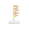Modelo Anatomico de Set Lumbar en 4 Pzas