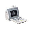 Ultrasonido Digital WED-9618 con Transductor Convexo y Lineal